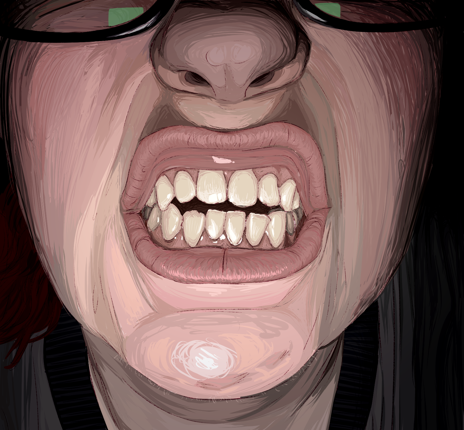 A painting of a mouth with lips open in a snarl to show the teeth. The teeth are crooked, with the top front teeth pushed out and the bottom front teeth pushed in, leaving a permanent gap between them. 